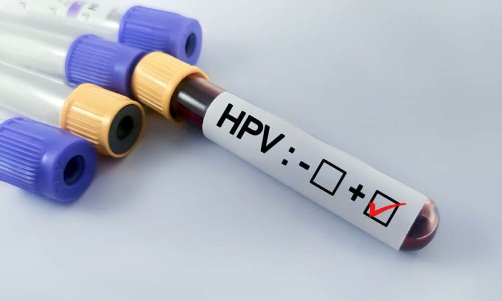 HPV