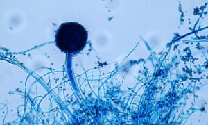 Aspergillus